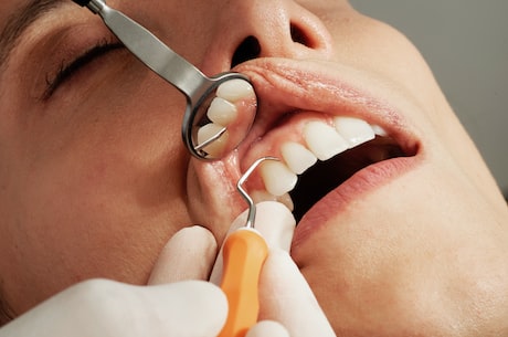 牙医在线：如何正确刷牙？